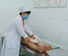 Điều trị bằng Nhu châm (Cấy chỉ)