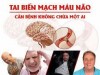 NHỮNG ĐIỀU CẦN BIẾT  KHI CHĂM SÓC NGƯỜI BỆNH  SAU TAI BIẾN MẠCH MÁU NÃO( TBMMN)