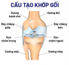 ĐIỀU TRỊ THOÁI HÓA KHỚP GỐI