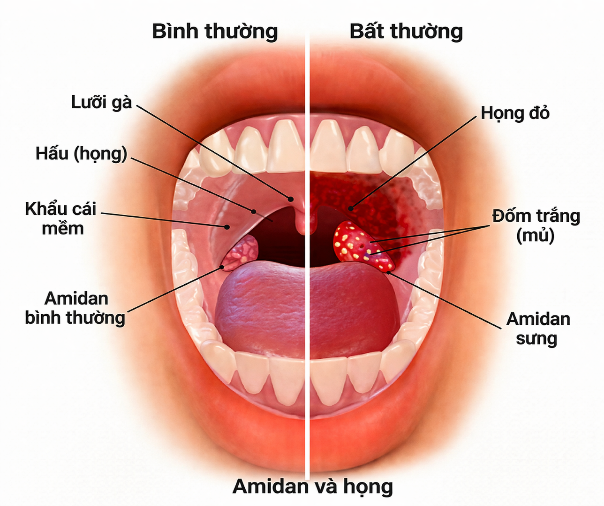 Hình 1. Giải phẫu vùng họng